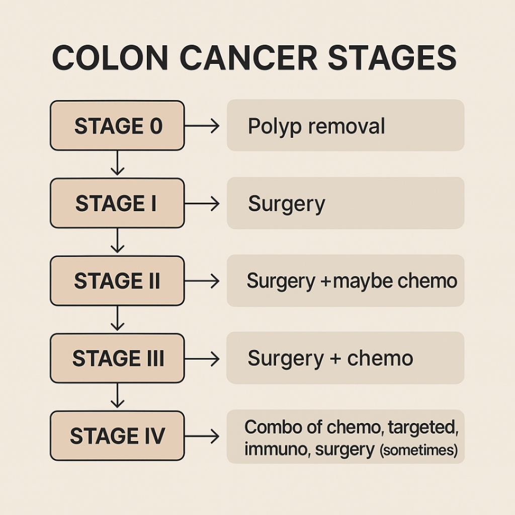 Minimalist infographic displaying colon cancer stages from 0 to IV with treatment options and progression arrows